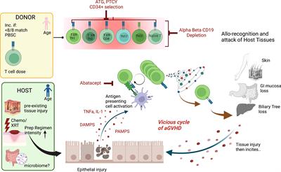 Controversies and expectations for the prevention of GVHD: A biological and clinical perspective